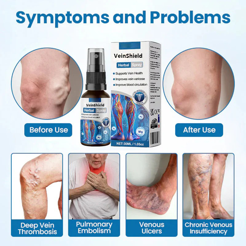π₯ ΠΠΎΡΠ»Π΅Π΄Π½ΠΈΡΠ΅ 3 ΡΠ°ΡΠ°: ΠΠΎ-Π³ΠΎΠ»ΡΠΌΠ° ΠΎΡΡΡΡΠΏΠΊΠ° Π·Π° Π²ΡΠΎΡΠΈΡ Π°ΡΡΠΈΠΊΡΠ»! π₯ VeinShield Herbal Spray - 94% ΠΎΡ ΠΏΠΎΡΡΠ΅Π±ΠΈΡΠ΅Π»ΠΈΡΠ΅ Π²ΠΈΠΆΠ΄Π°Ρ Π²ΠΈΠ΄ΠΈΠΌΠΈ ΡΠ΅Π·ΡΠ»ΡΠ°ΡΠΈ Π² ΡΠ°ΠΌΠΊΠΈΡΠ΅ Π½Π° 1 Π΄ΠΎ 2 ΡΠ΅Π΄ΠΌΠΈΡΠΈ!