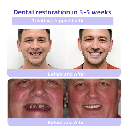 Oyikey®✅ Минерален прах за възстановяване на зъби