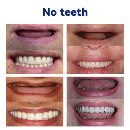 HAIMUZIL™ 🦷Комплект силиконови линийки за протези (съвместими с ADA и одобрени от зъболекари)